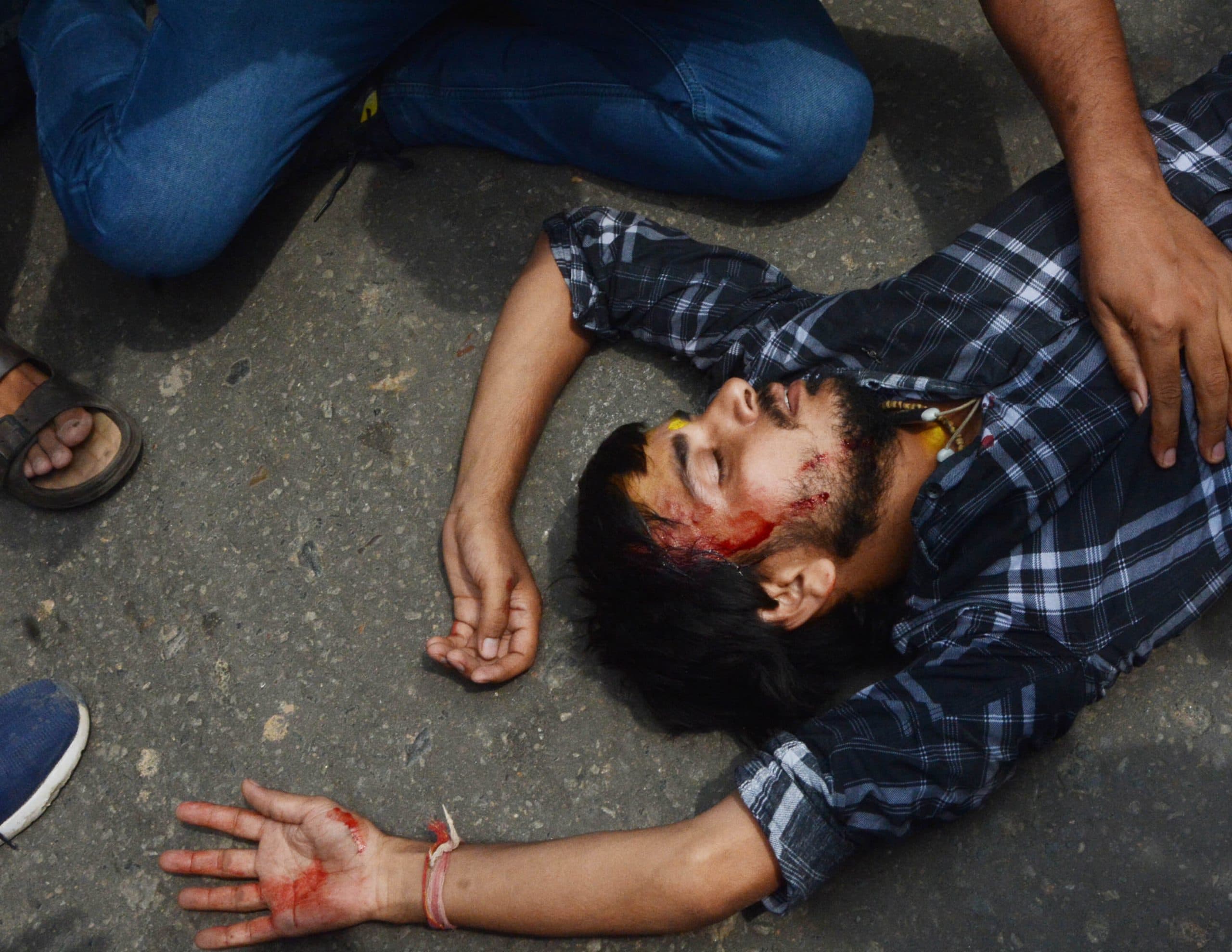 Patna News : टीआरइ-4 के पहले एसटीइटी की मांग को लेकर प्रदर्शन कर रहे अभ्यर्थियों पर लाठीचार्ज