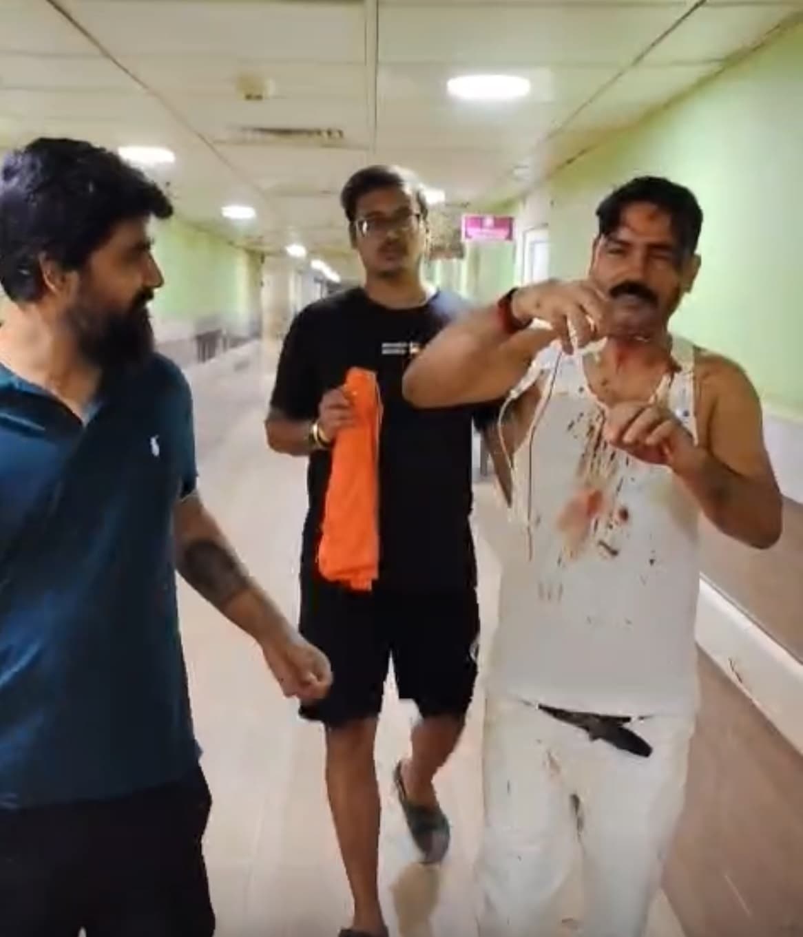 Patna News : पुलिस को सूचना देने पर भड़के नशेड़ी, पीट कर सिर को फोड़ा