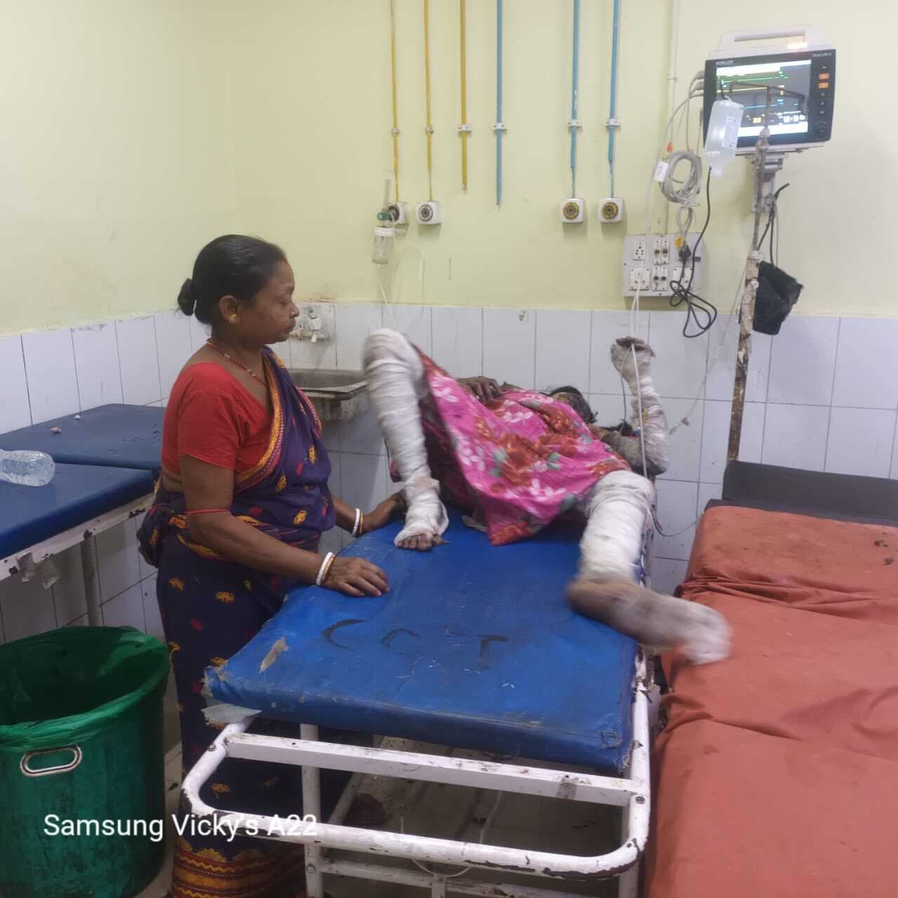 Dhanbad News: घरेलू विवाद में महिला ने खुद को लगायी आग