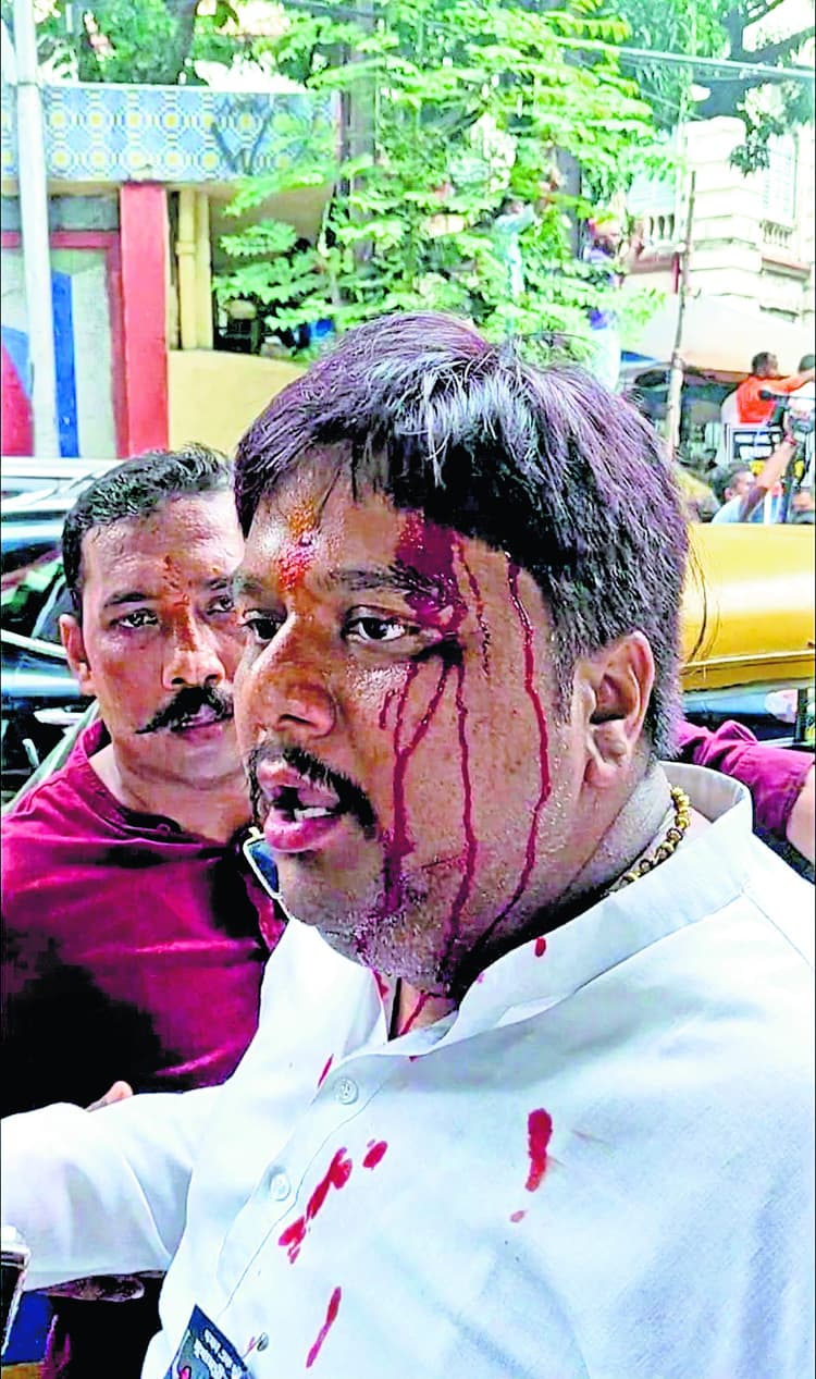 भाजपा नेता प्रियांगु पांडे का सिर फटा