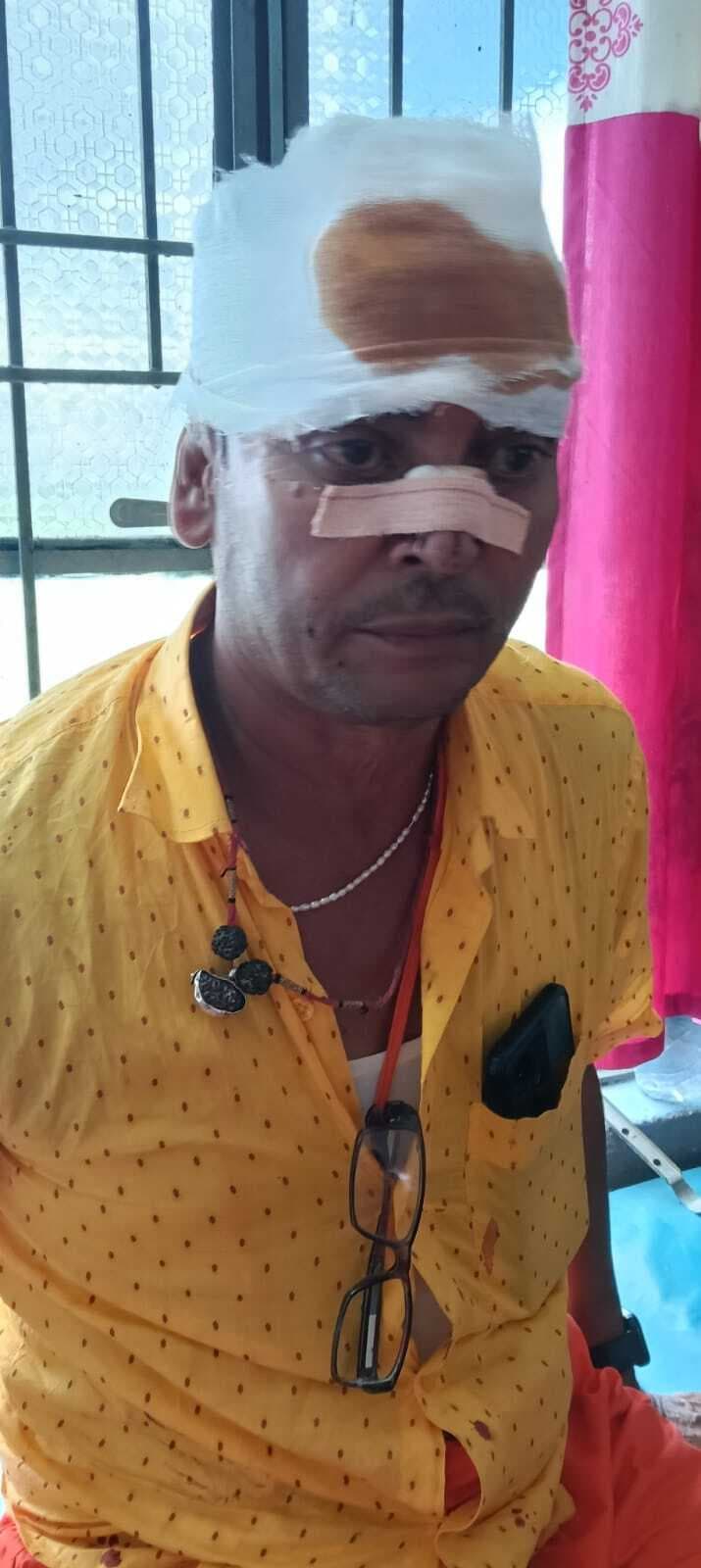 बेकाबू कार पेड़ से टकराई,  पूर्वी चंपारण के पांच कांवरिये घायल