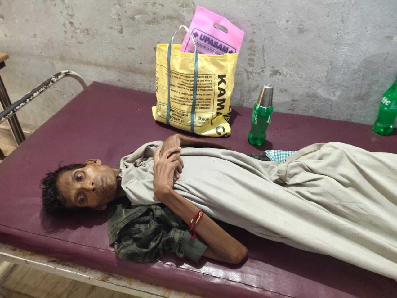 East Singhbhum News : टीबी से डुमरिया के युवक की हालत गंभीर, एमजीएम रेफर