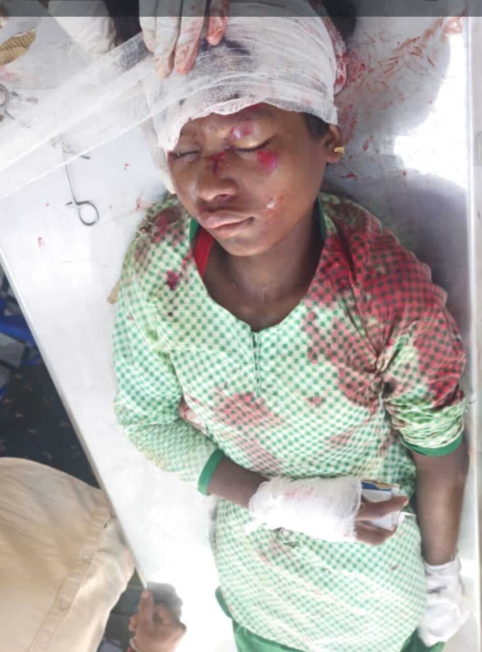 बाइक की टक्कर से स्कूली छात्रा गंभीर, रांची रेफर, चालक भी घायल