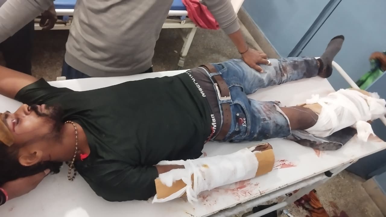 स्कॉर्पियो से टक्कर में बाइक सवार घायल, रेफर