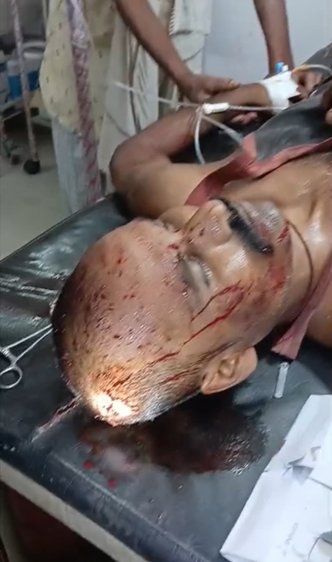 Motihari: अंतरजातीय शादी करने को लेकर पति-पत्नी की जमकर पिटाई