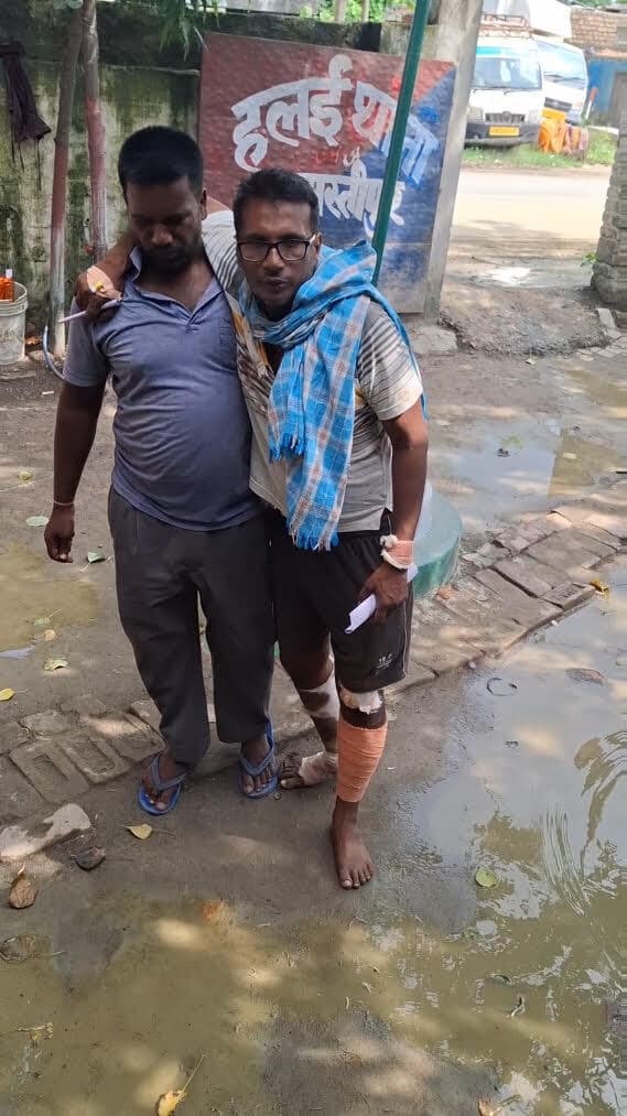 Samastipur : चकजलाल के युवक की बेरहमी से पिटाई, प्राथमिकी