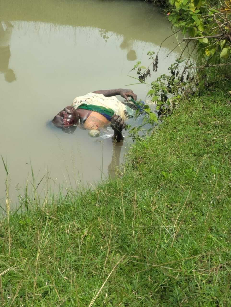 गड्ढे में गिरने से विक्षिप्त महिला की मौत, मामला दर्ज