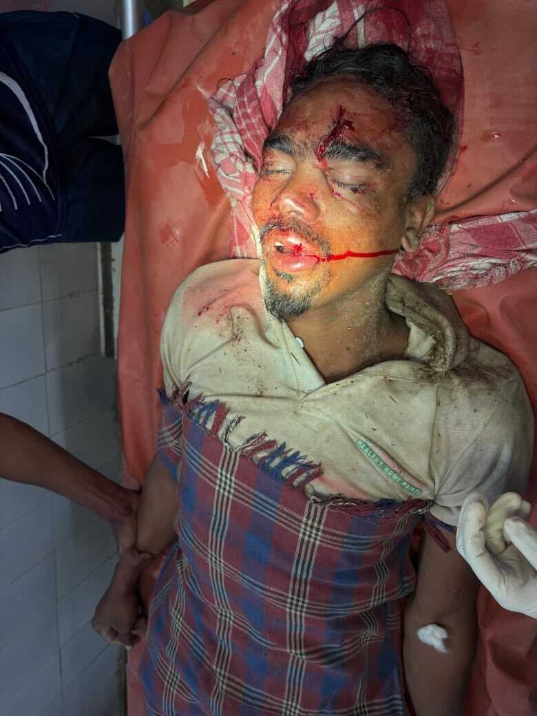 लाठी-डंडे से पीट कर भाई को किया घायल