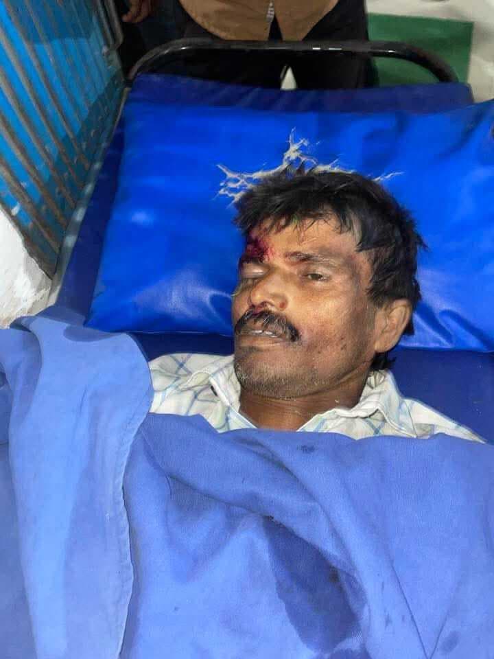 बल्लालपुर में तीन वाहनों की टक्कर में पिता-पुत्र की मौत