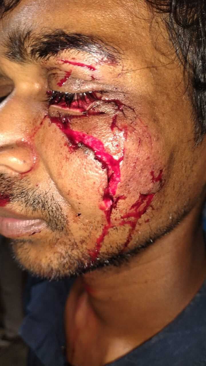 दो लोगों को कुत्ते ने काटकर किया घायल