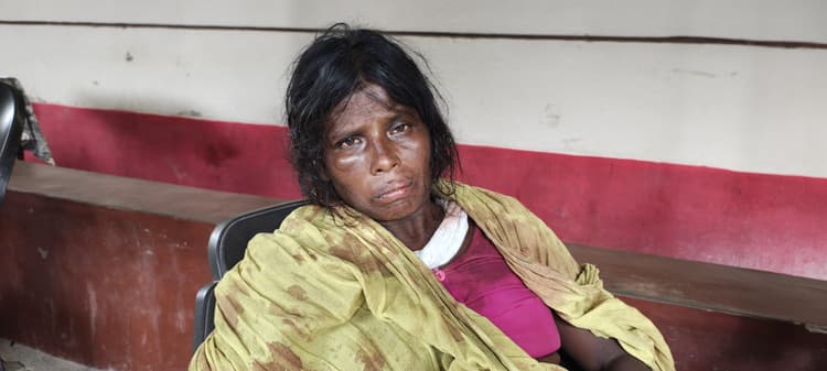 जमीन विवाद को लेकर गोतनी और सास ने मारकर किया घायल