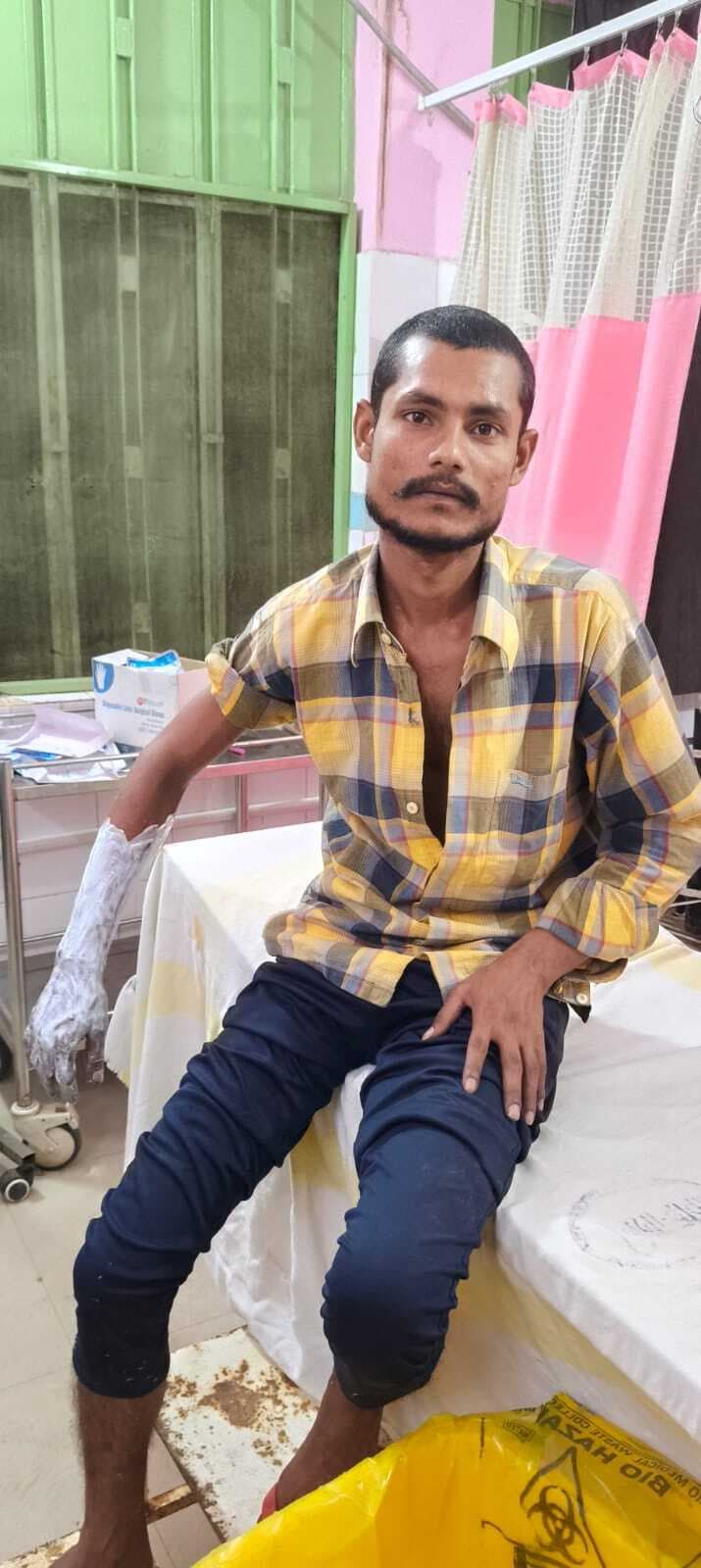 चूल्हा में आग लगाने के दौरान युवक का हाथ झूलसा