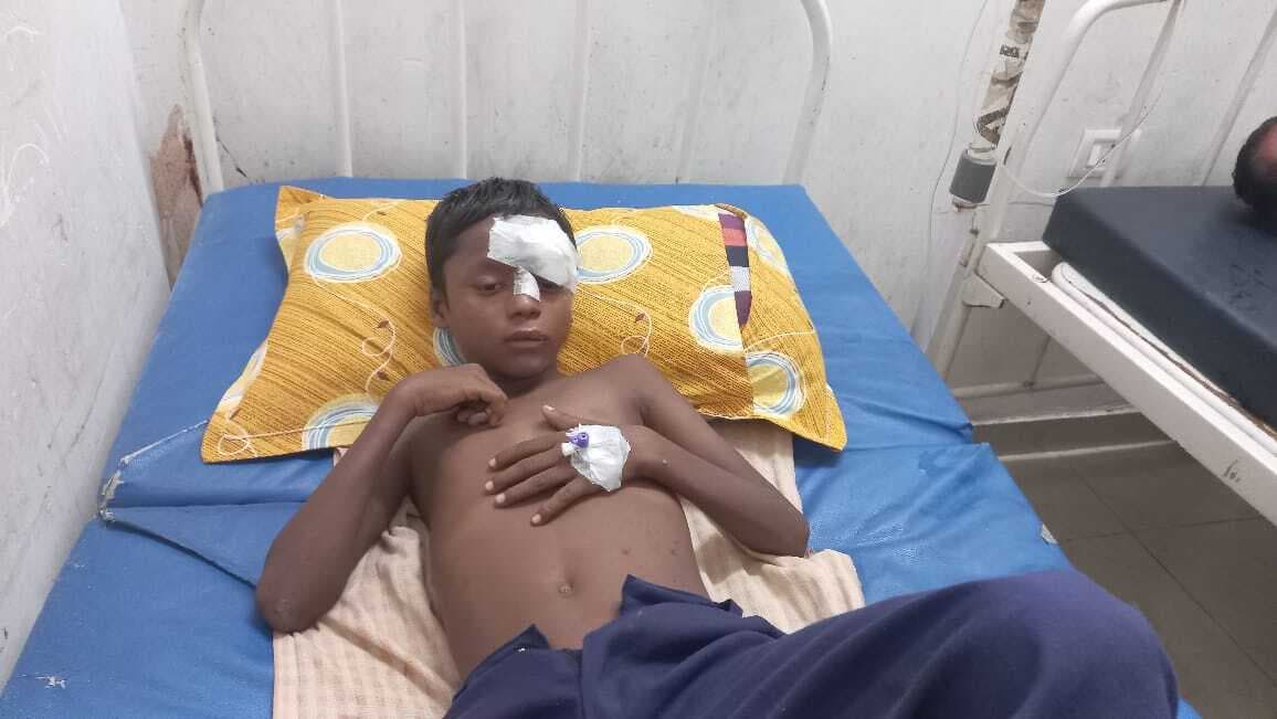 उमवि जगदीशपुर के प्रधानाध्यापक ने पांचवी के छात्र को पीटा, घायल