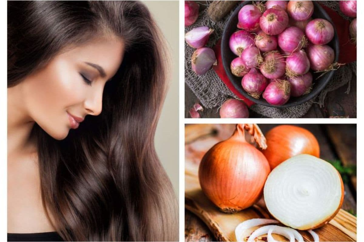 Onion For Hair Fall: अगर आप भी झड़ते बालों से हैं परेशान तो ट्राय करें प्याज का मैजिक ट्रिक्स Onion For Hair Fall: अगर आप भी झड़ते बालों से हैं परेशान तो ट्राय करें प्याज का मैजिक ट्रिक्स