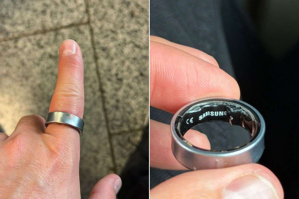 Samsung Galaxy Ring बना मुसीबत, पहनने वाले यूजर की हालत बिगड़ी, अस्पताल तक पहुंचा मामला