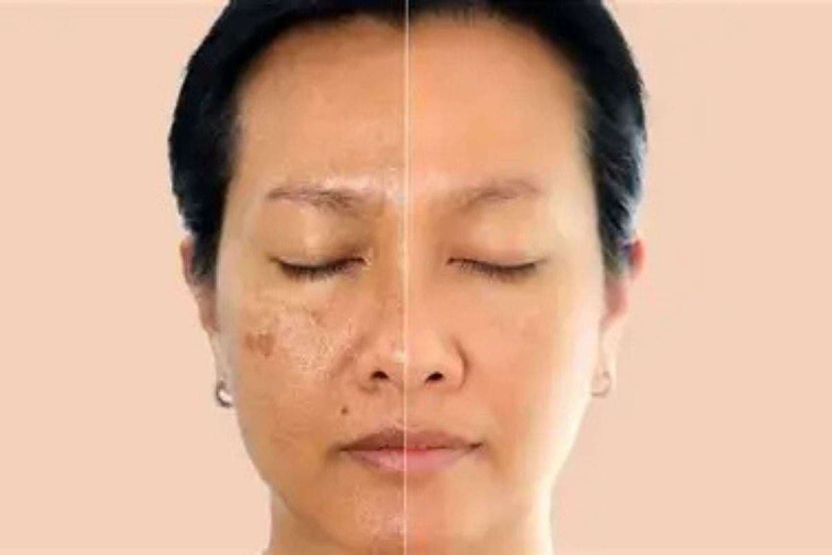 Skin Care Tips Skin Care Tips