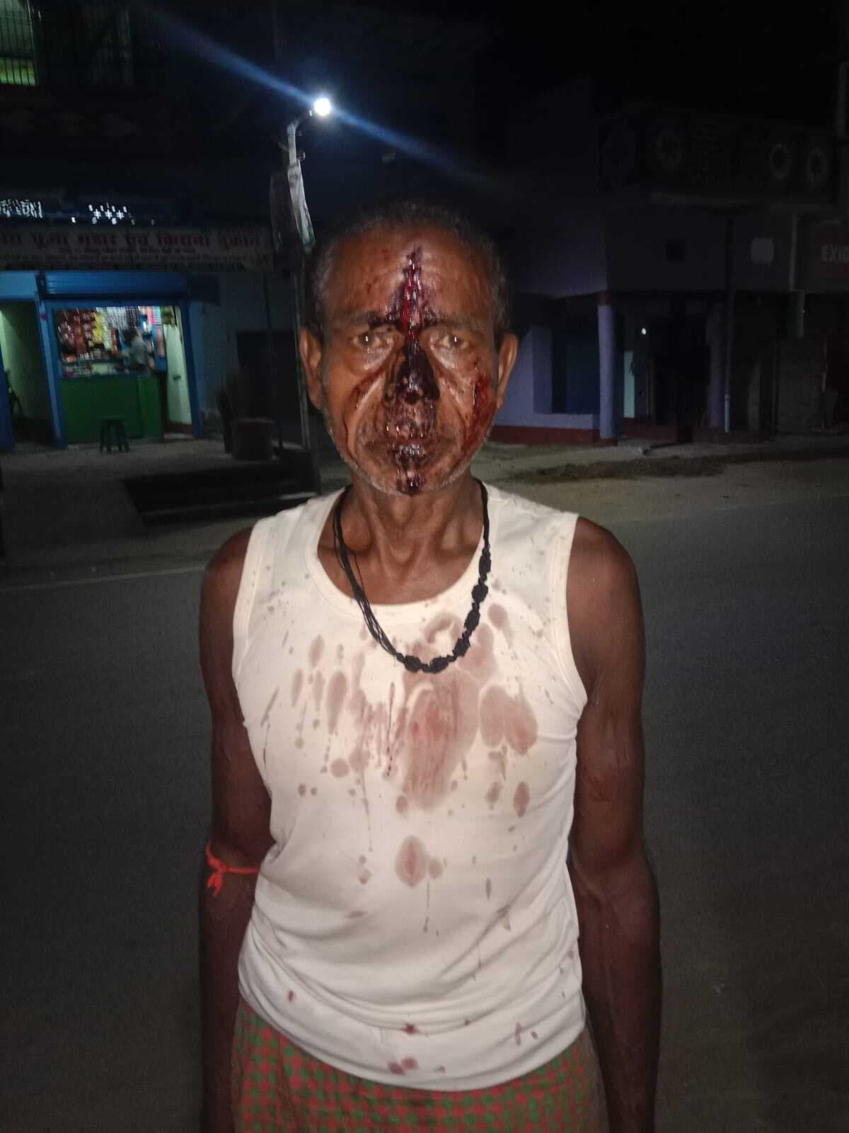 वजीरगंज में पटवन विवाद को लेकर वार्ड सदस्य पर हमला