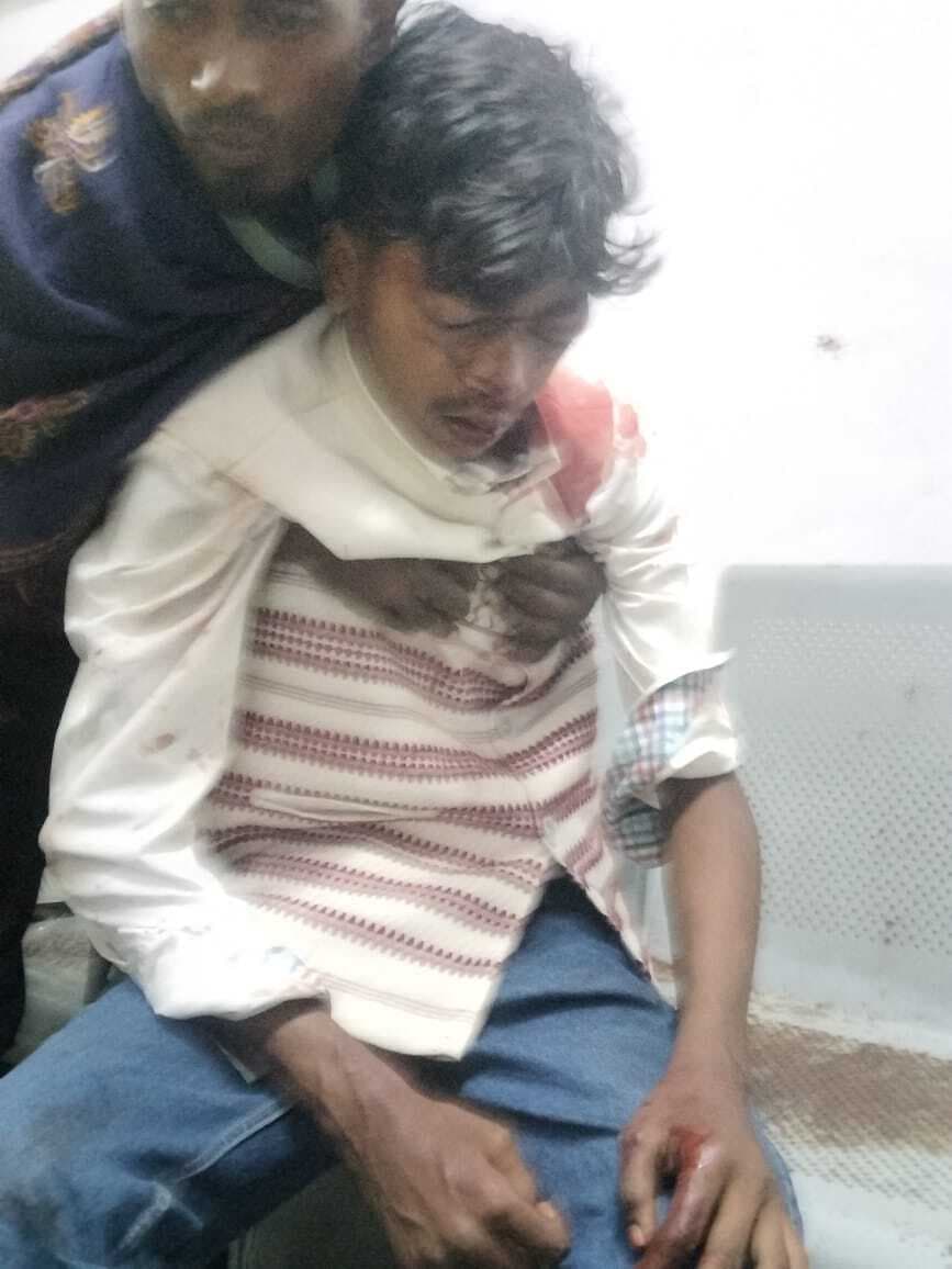 सड़क हादसे में चार युवक घायल