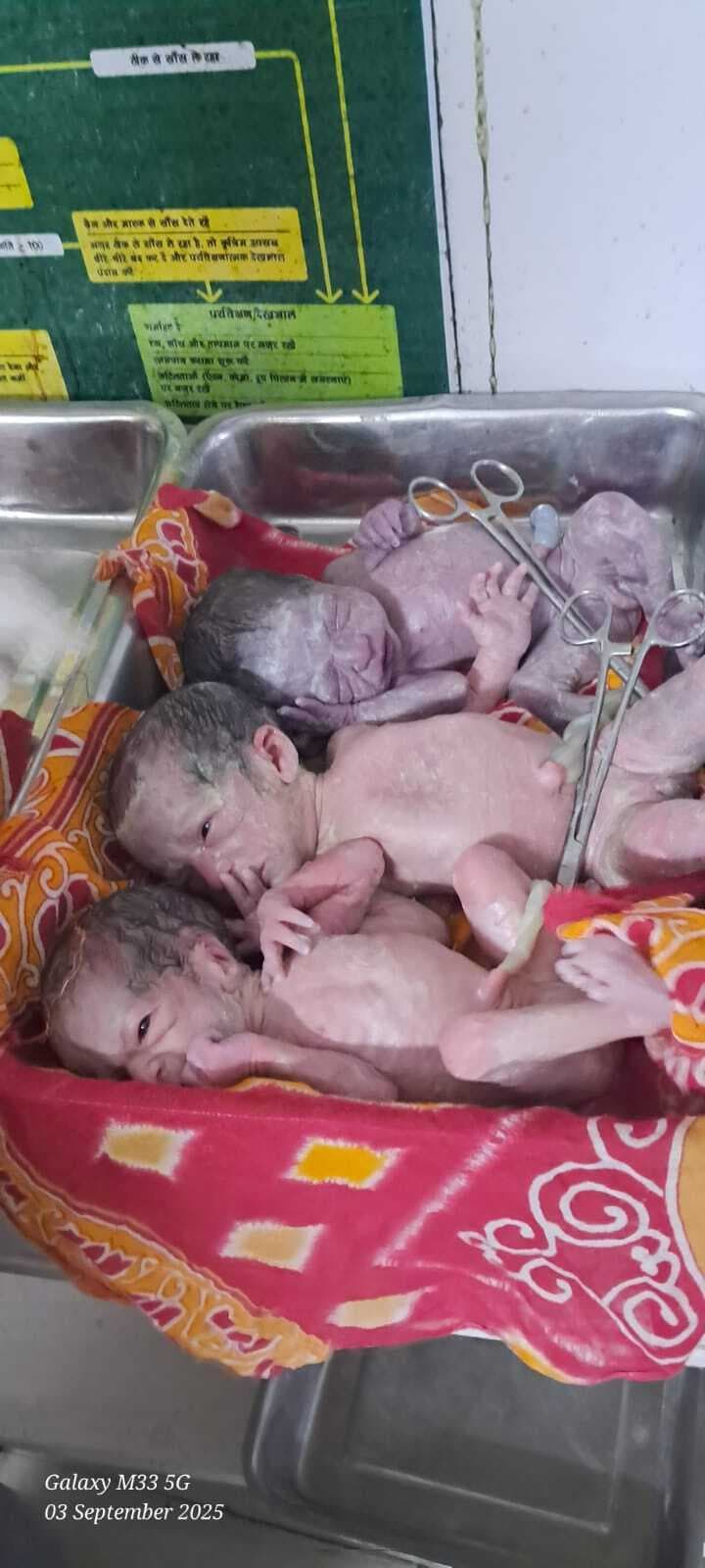 Dhanbad News : जोड़ाफाटक रोड की महिला ने तीन बच्चियों को दिया जन्म