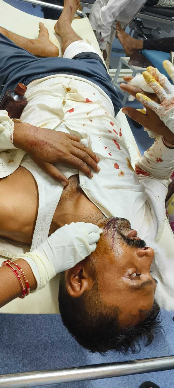 बाइक से गिरकर युवक घायल, ट्राॅमा सेंटर रेफर