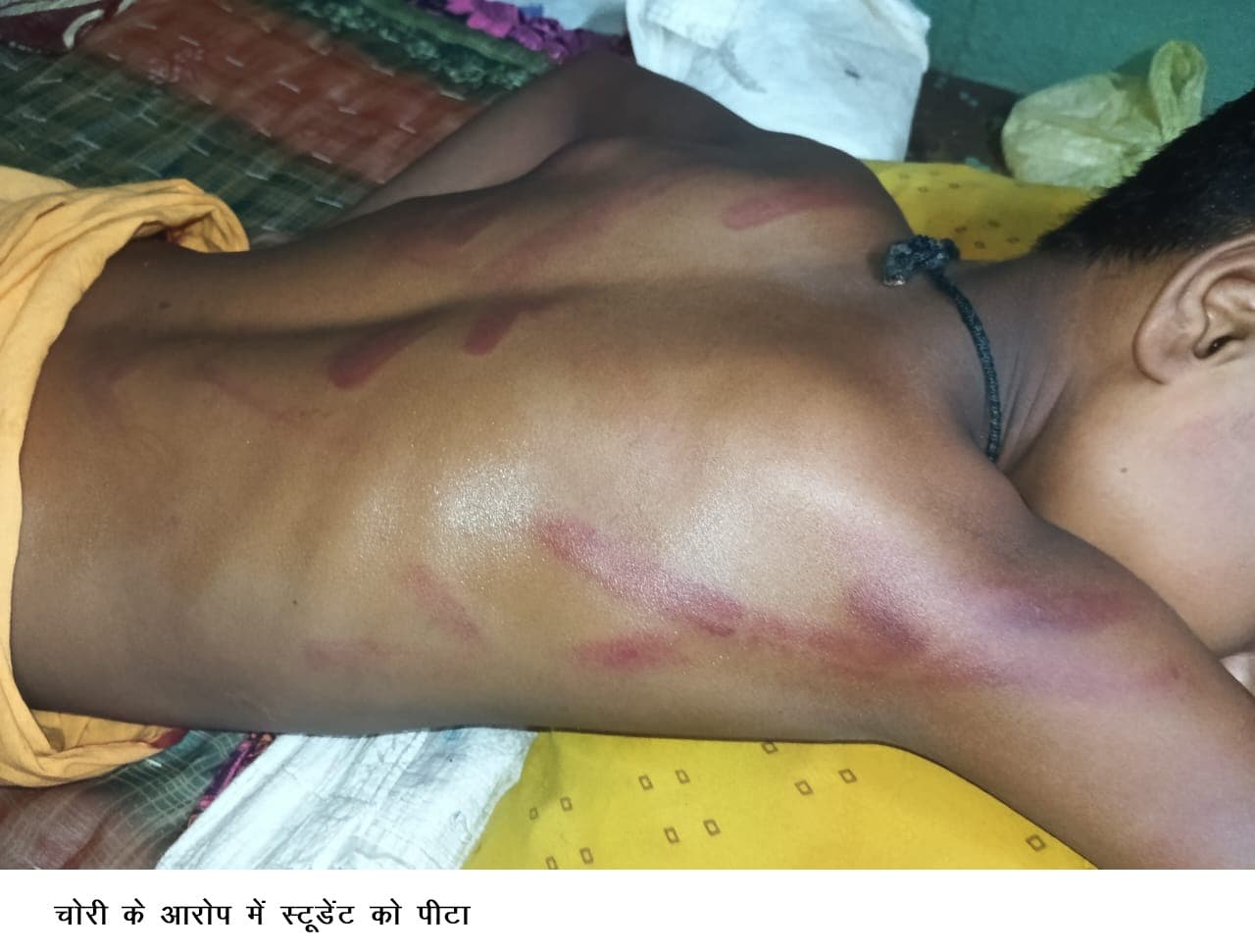 चोरी के आरोप में शिक्षक ने किशोर को पीटा, हिरासत में