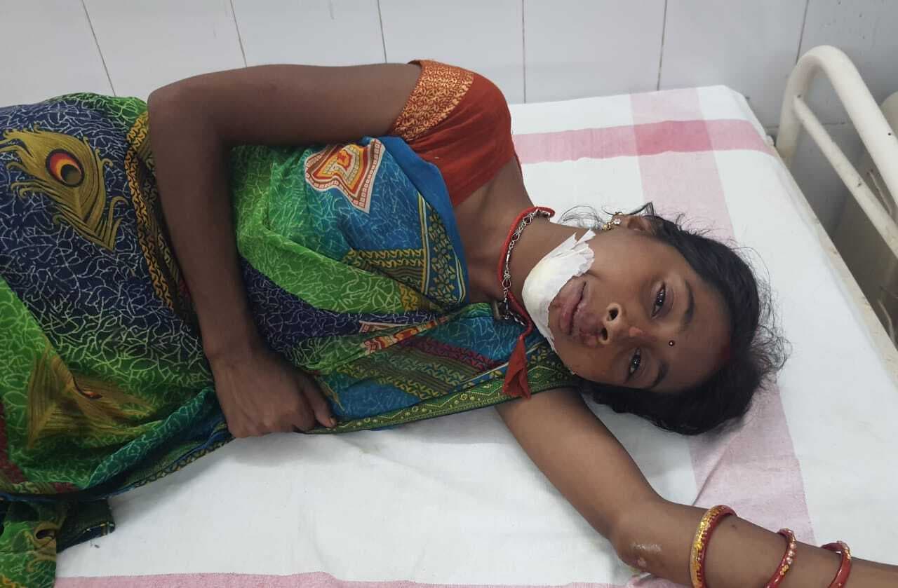 कोल्हुआ मोड़ पर बाइक से गिरकर मां व दूधमुंही बेटी घायल