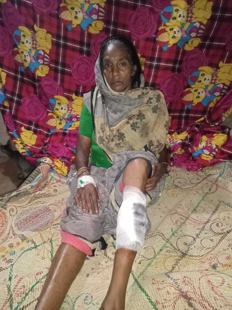 बंदर के हमले से वृद्ध महिला घायल