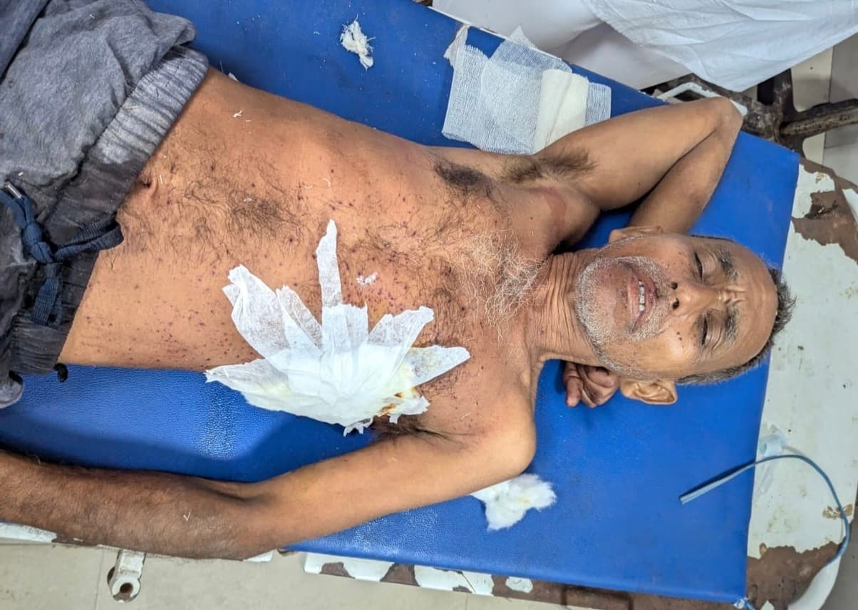 झगड़ा सुलझाने के दौरान अधेड़ को मारी गोली, हालत गंभीर