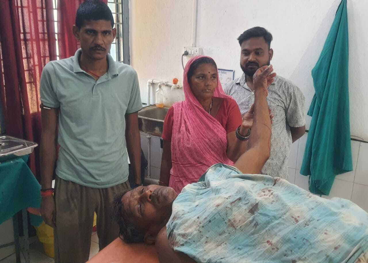 जमीन विवाद में छोटे भाई ने बड़े को कुल्हाड़ी से प्रहार कर किया घायल