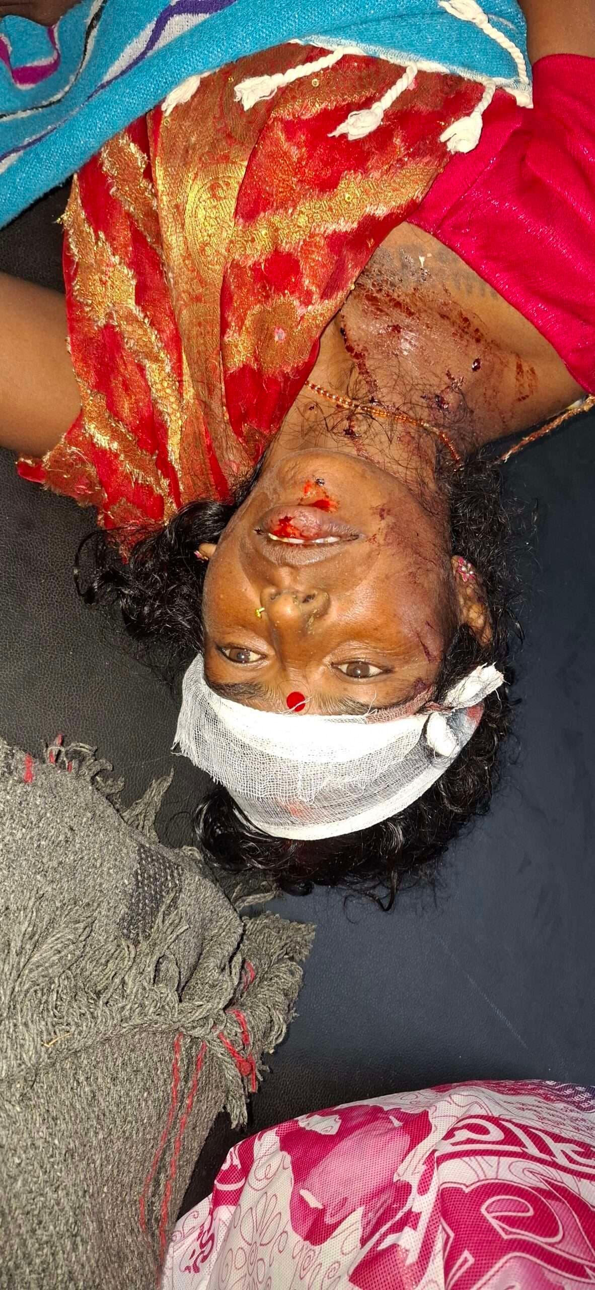 Giridih News :चारपहिया की चपेट में आकर बाइक सवार दंपती घायल