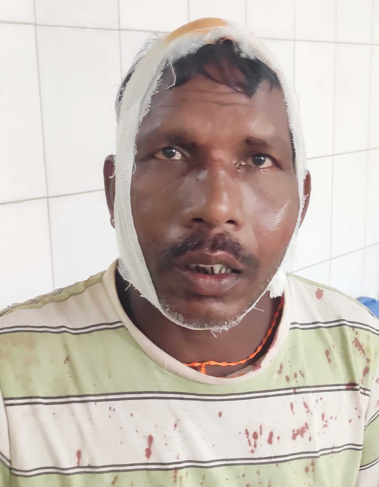 युवती से छेड़खानी का विरोध करने पर चाचा की जमकर पिटाई