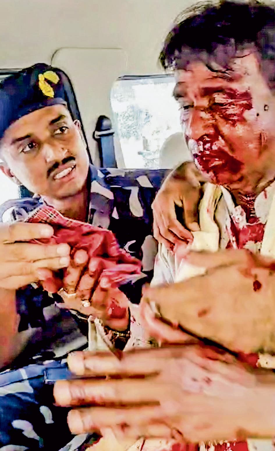 भाजपा सांसद खगेन मुर्मू व विधायक शंकर घोष पर जानलेवा हमला