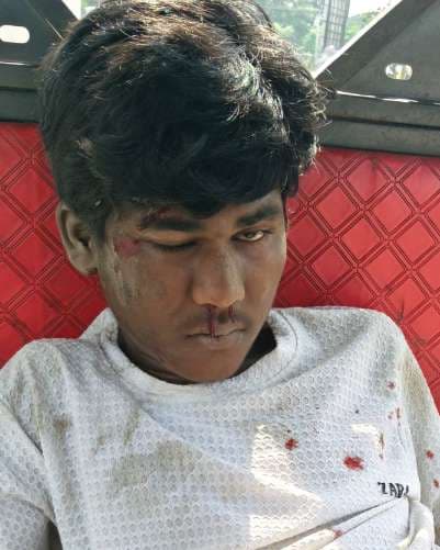 टैंकलॉरी  की ठोकर से स्कूटी सवार की मौत, अन्य घायल