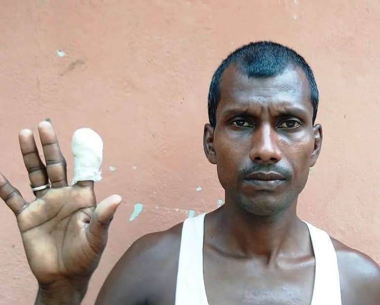 वार्ड सदस्य प्रतिनिधि पर चाकू से हमला, एक उंगली कटी