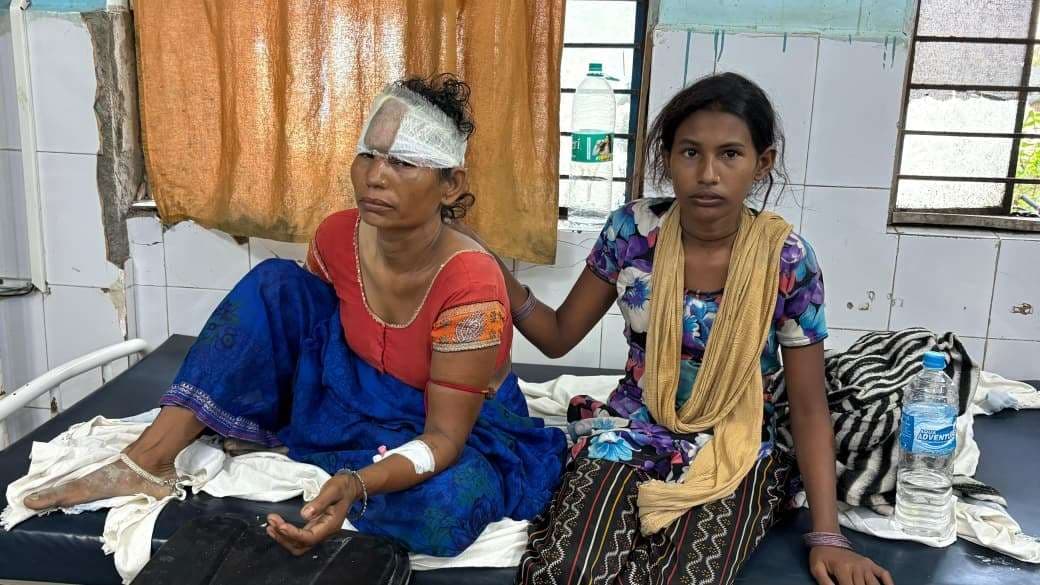 बिंद टोली में विवाद ने लिया हिंसक रूप, मां-बेटा घायल