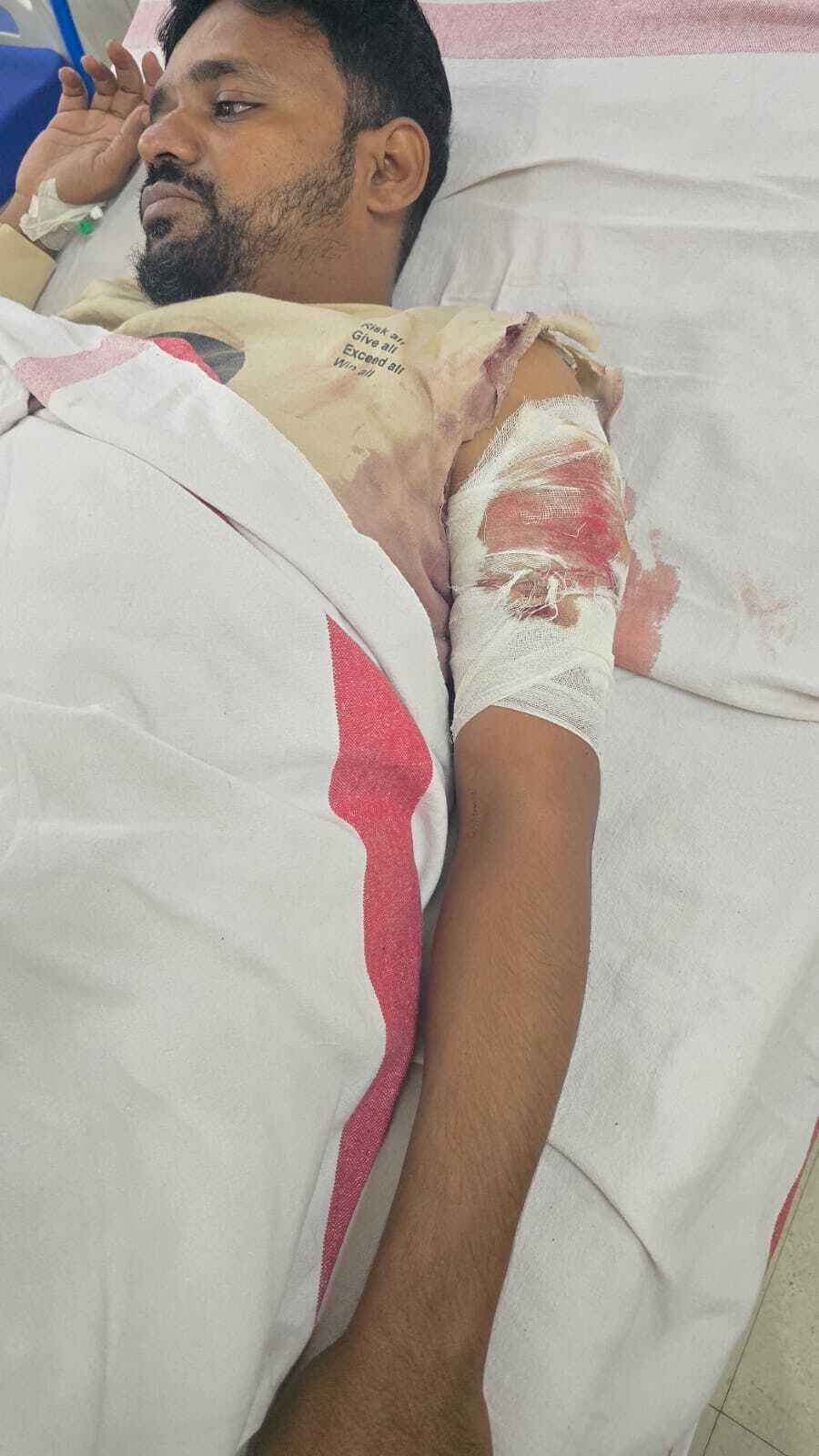 आपसी रंजिश में अपराधियों ने चलायी गोली, बाल-बाल बच्चा युवक