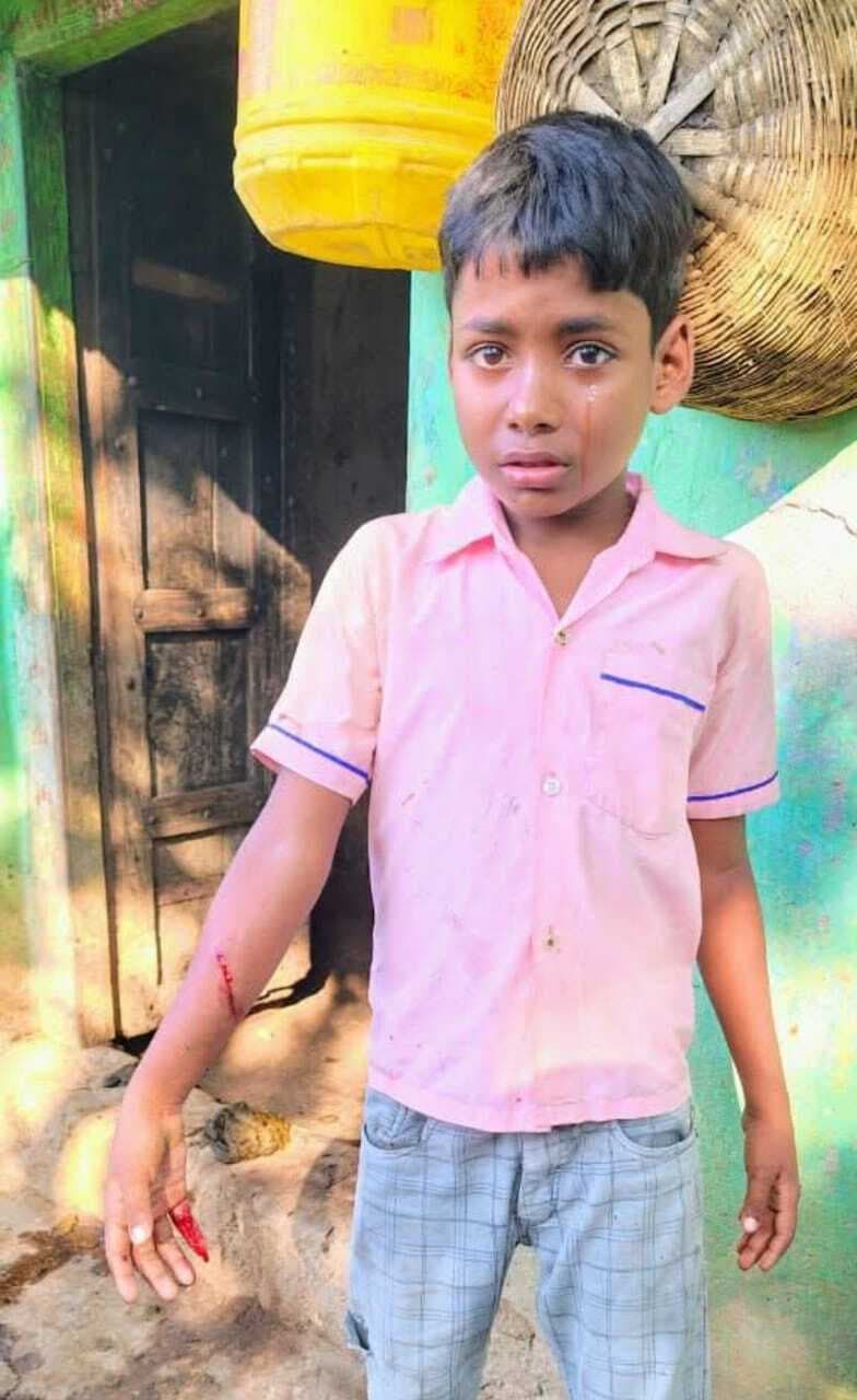 Bokaro news: कुत्ते ने कई लोगों को काट कर किया जख्मी