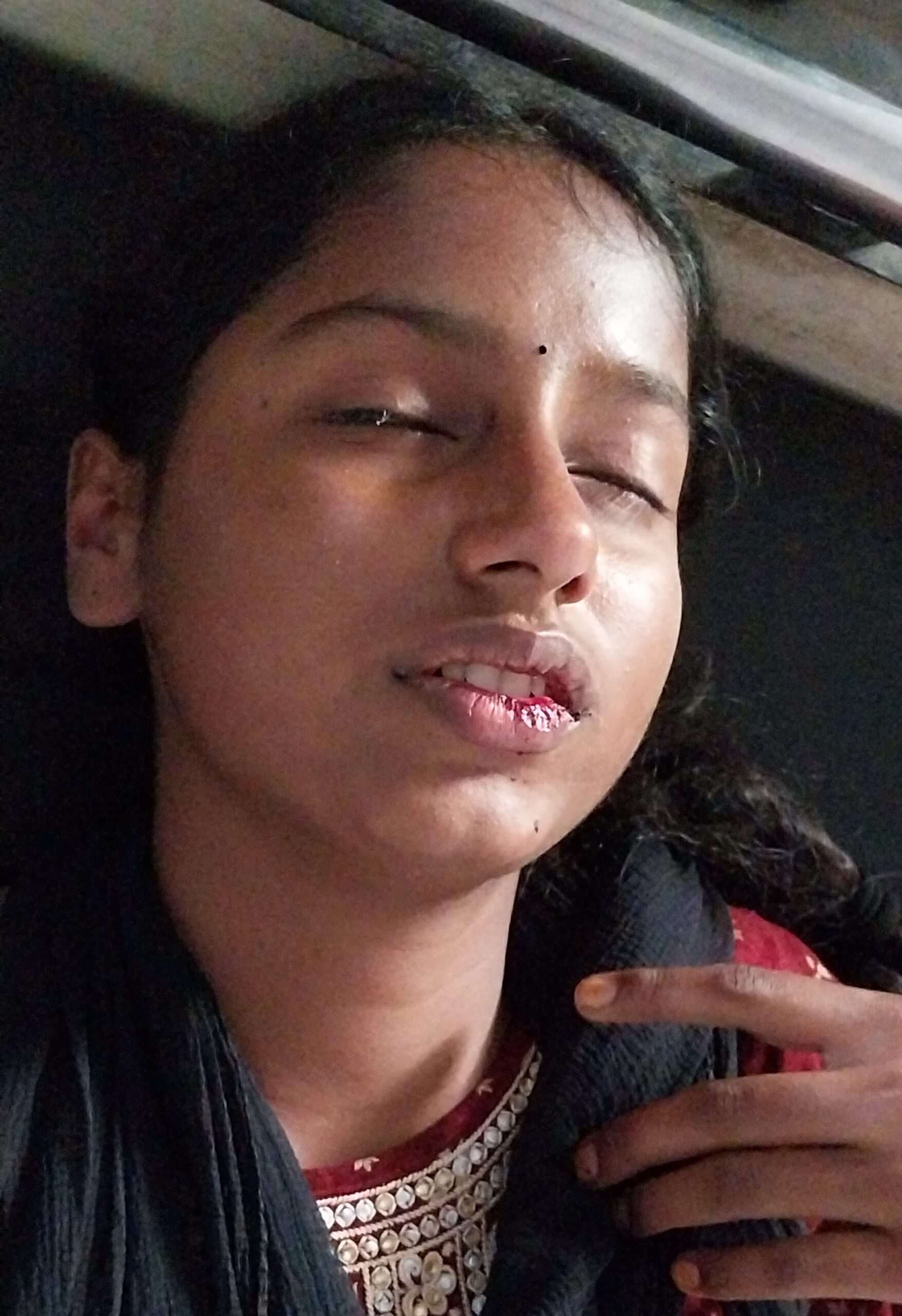 Giridih News : माखमरगो में जमीन विवाद में दो पक्षों में मारपीट, छह घायल