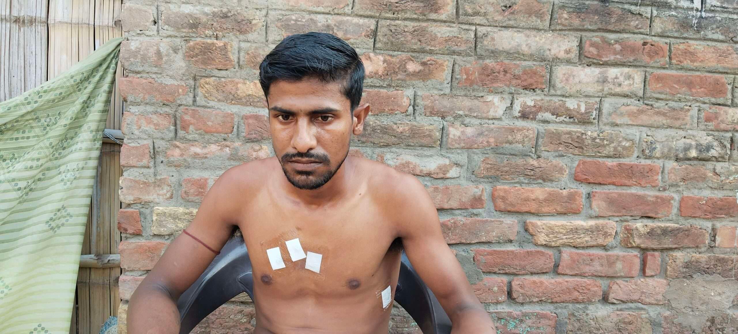 Motihari: प्रदेश से घर आये युवक पर चाकू से हमला