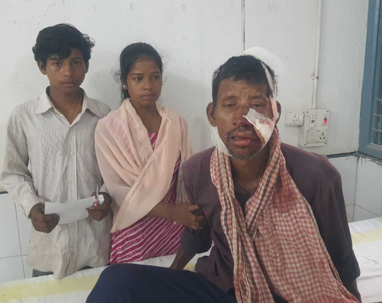 पेड़ से टकराकर अनियंत्रित बाइक दुर्घटनाग्रस्त, जख्मी चालक रेफर