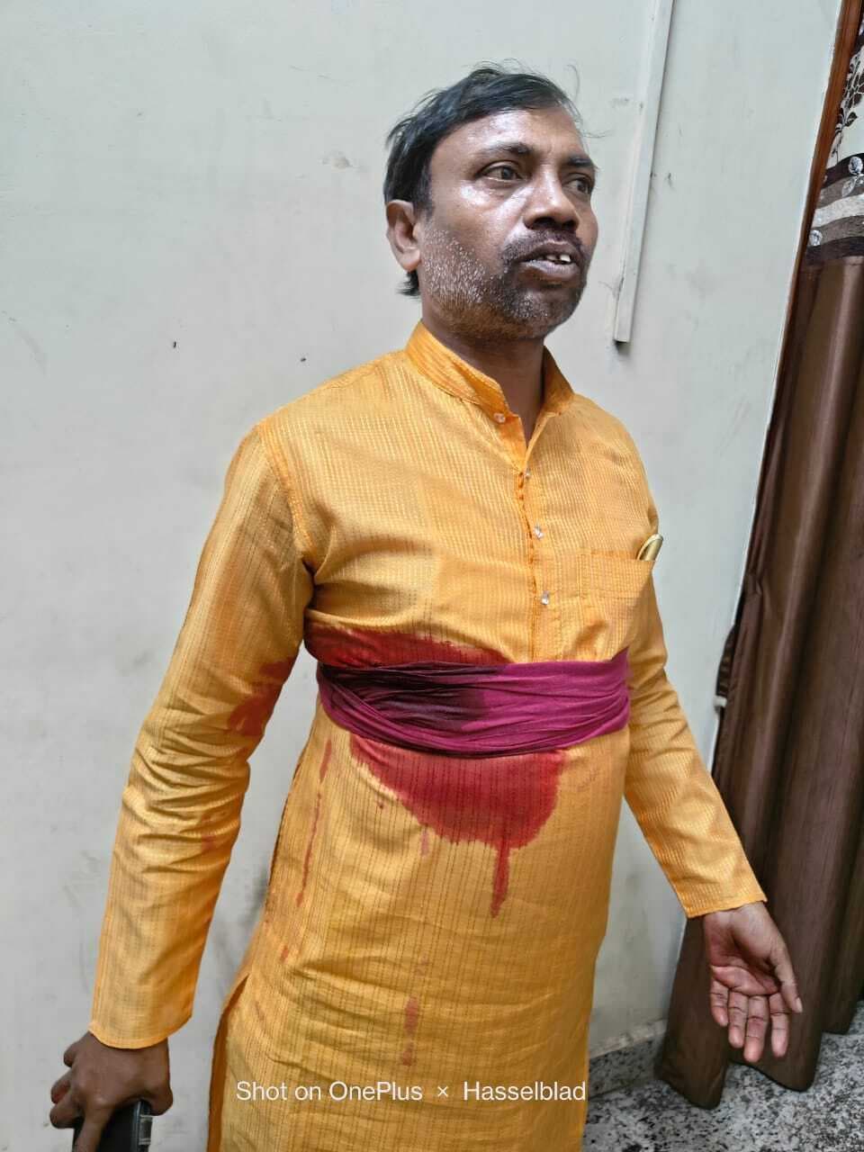 Dhanbad News: गाड़ी आगे बढ़ाने को कहा, तो अधिवक्ता ने भुजाली से बाइक सवार पर किया हमला