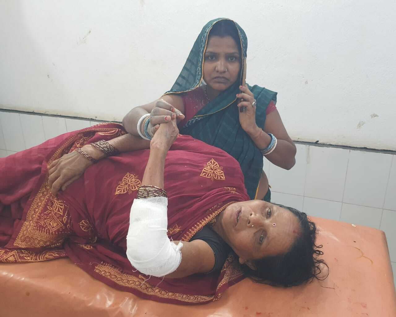 ऑटो के धक्के से बाइक सवार दंपती घायल, देवघर रेफर