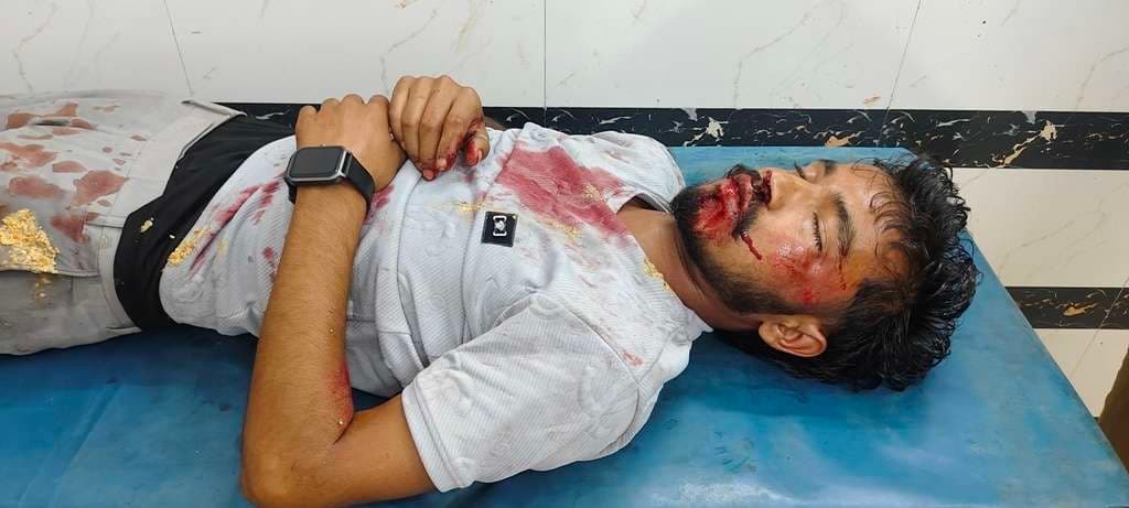 सड़क दुर्घटना में बाइक सवार युवक जख्मी