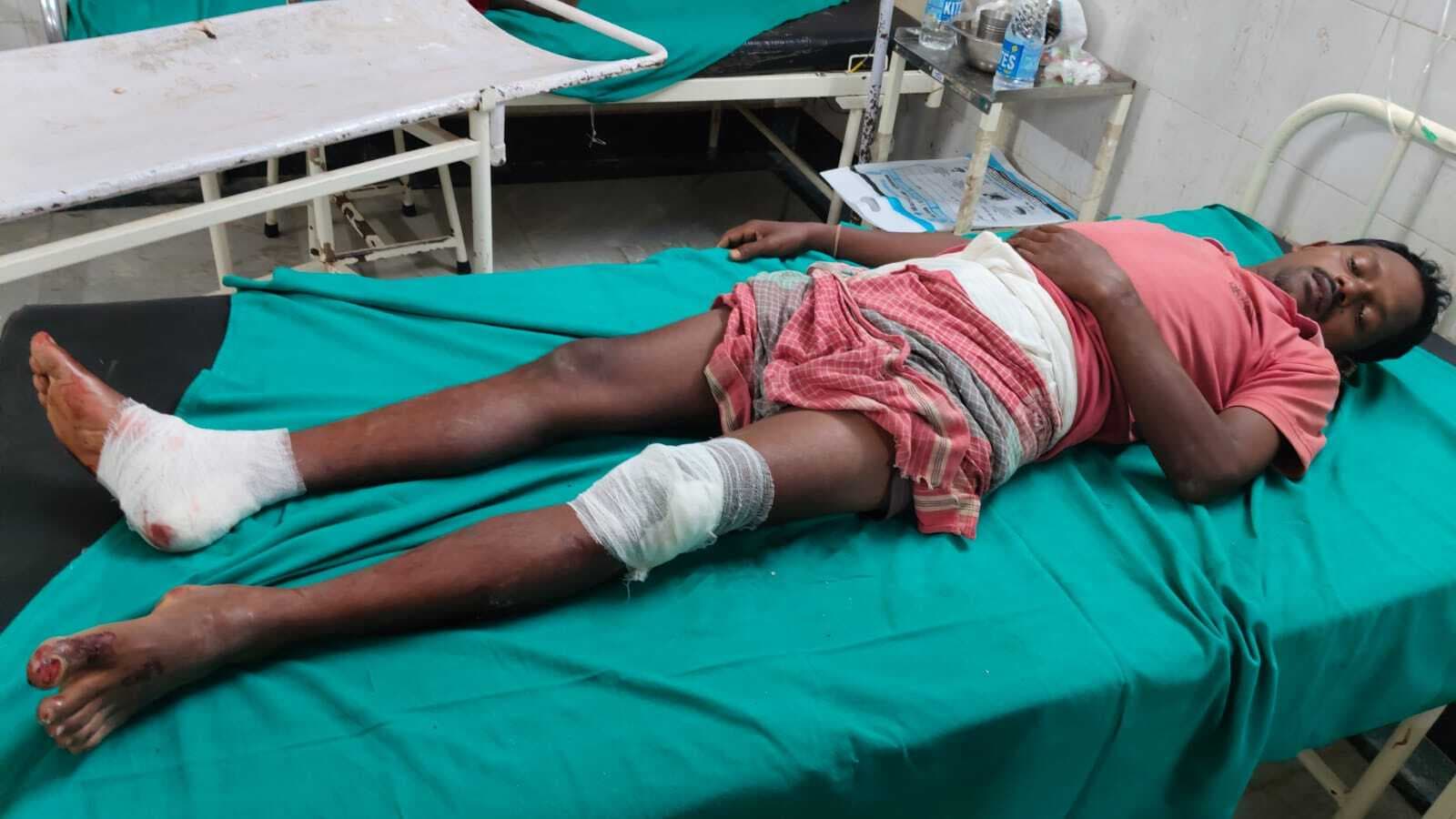 Accident News : हादसे में महिला की मौत, बाइक चालक घायल, भर्ती