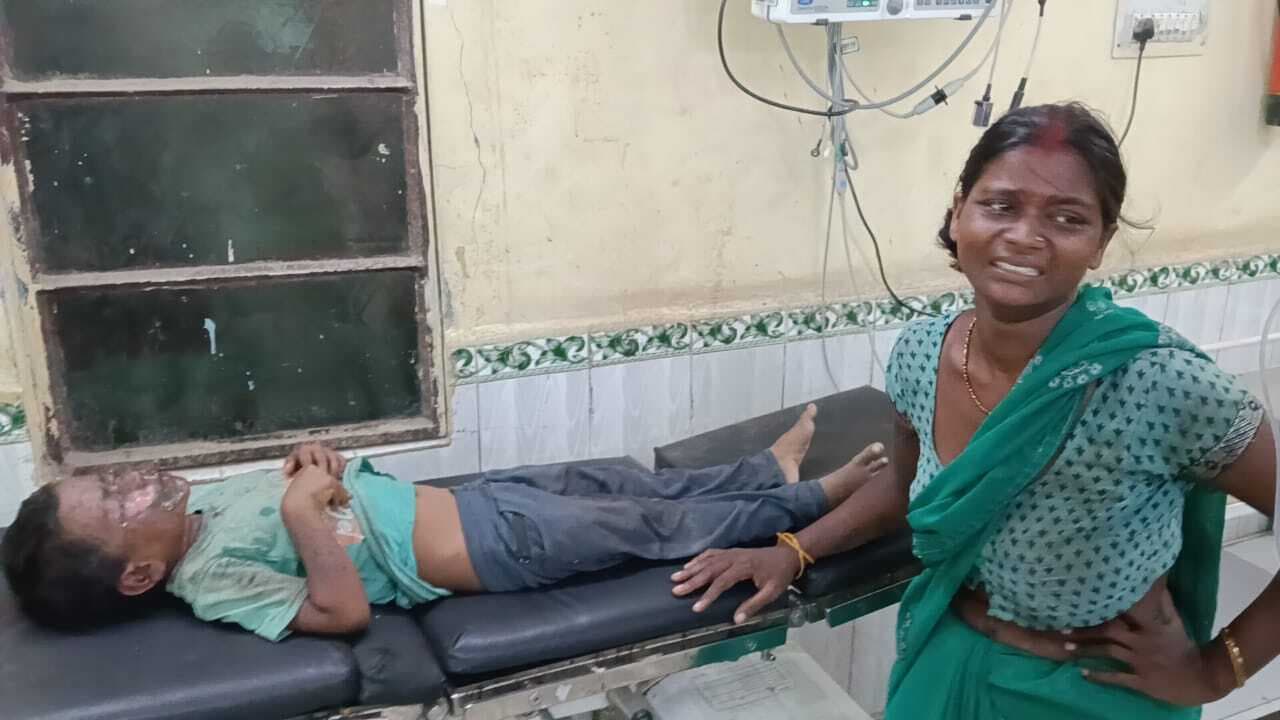 दीपावली की रात पटाखों ने मचायी तबाही, 40 लोग झुलसे , कई की हालत गंभीर