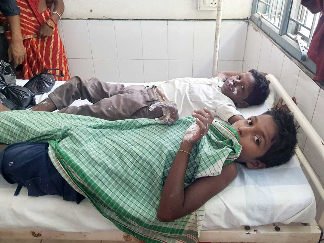 पटाखा जलाने के दौरान चचेरे भाईयों समेत चार बच्चे झुलसे