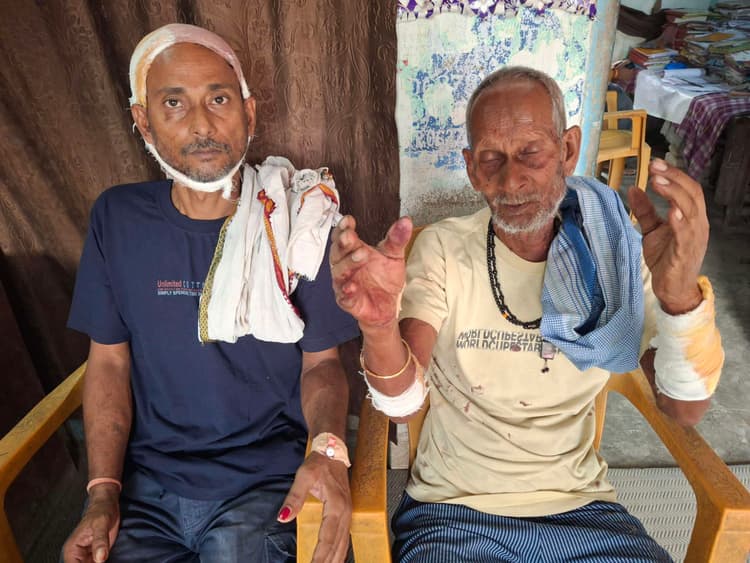 Samastipur : पचभिंढा में कुदाल से प्रहार कर बाप-बेटे को किया जख्मी