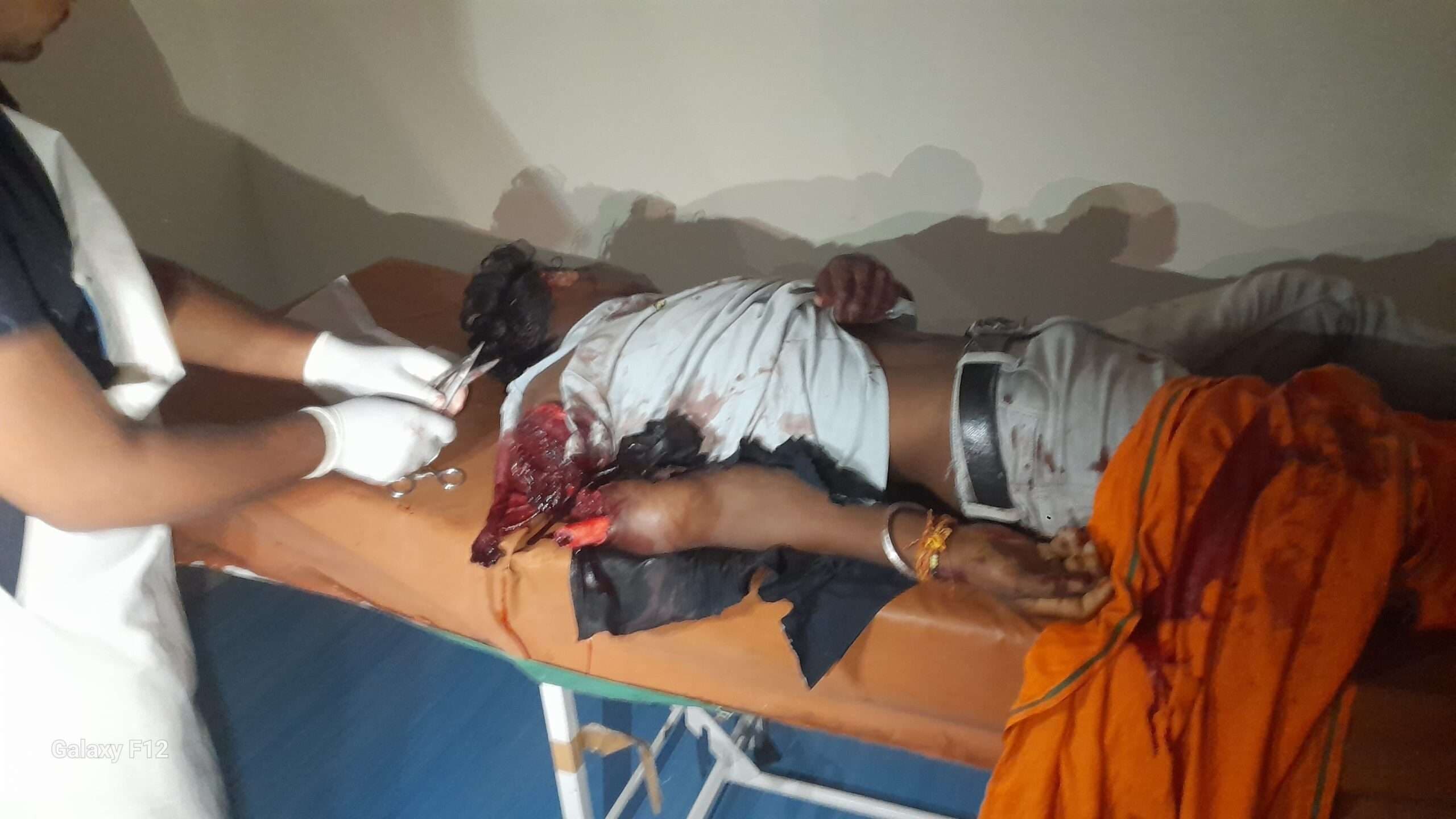 Giridih News :चारपहिया की टक्कर से बाइक सवार तीन युवक घायल