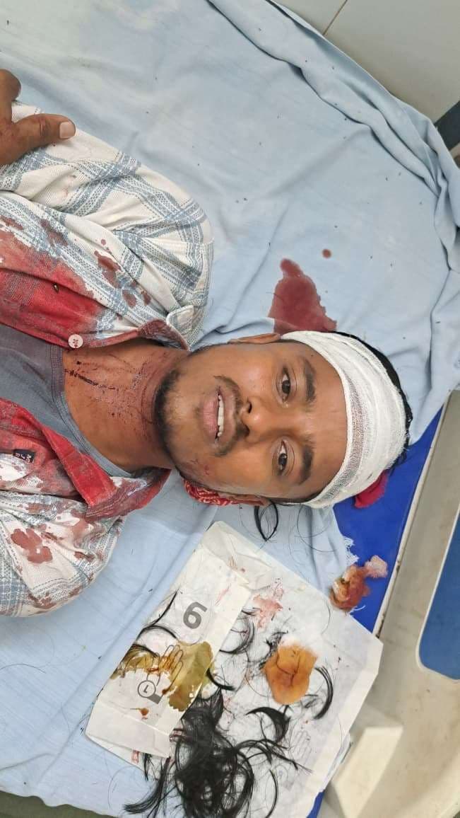 पटाखा फोड़ने के विवाद में दो पक्षों में मारपीट, आधे दर्जन घायल, चार रेफर