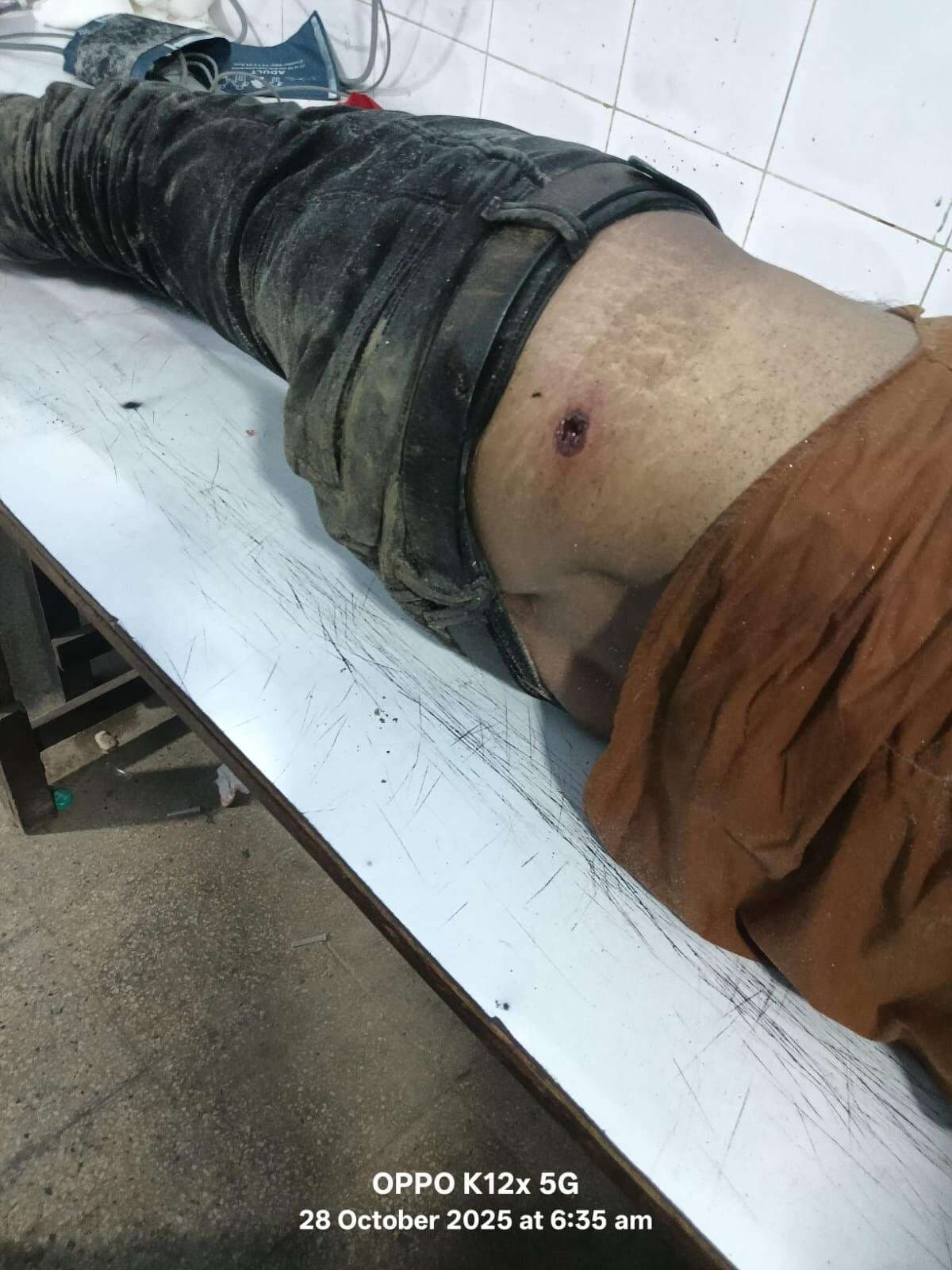 छठ पूजा के दौरान युवक को अपराधियों ने मारी गोली, गंभीर